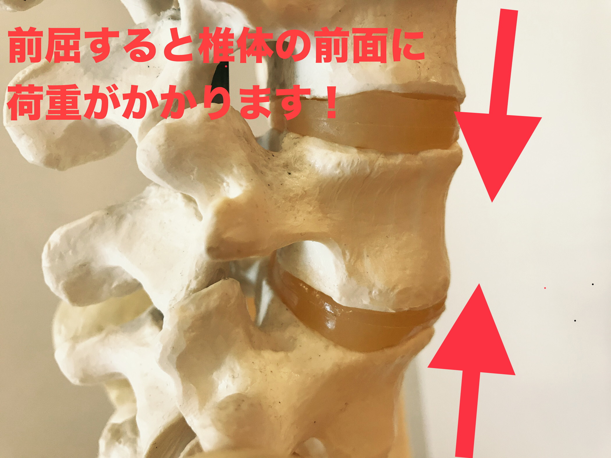 腰椎椎間板ヘルニアは前屈時に悪化する！ | 神戸市灘区の【腰痛専門 